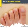 Yellow Toenails From Nail Polish Causes & Solutions